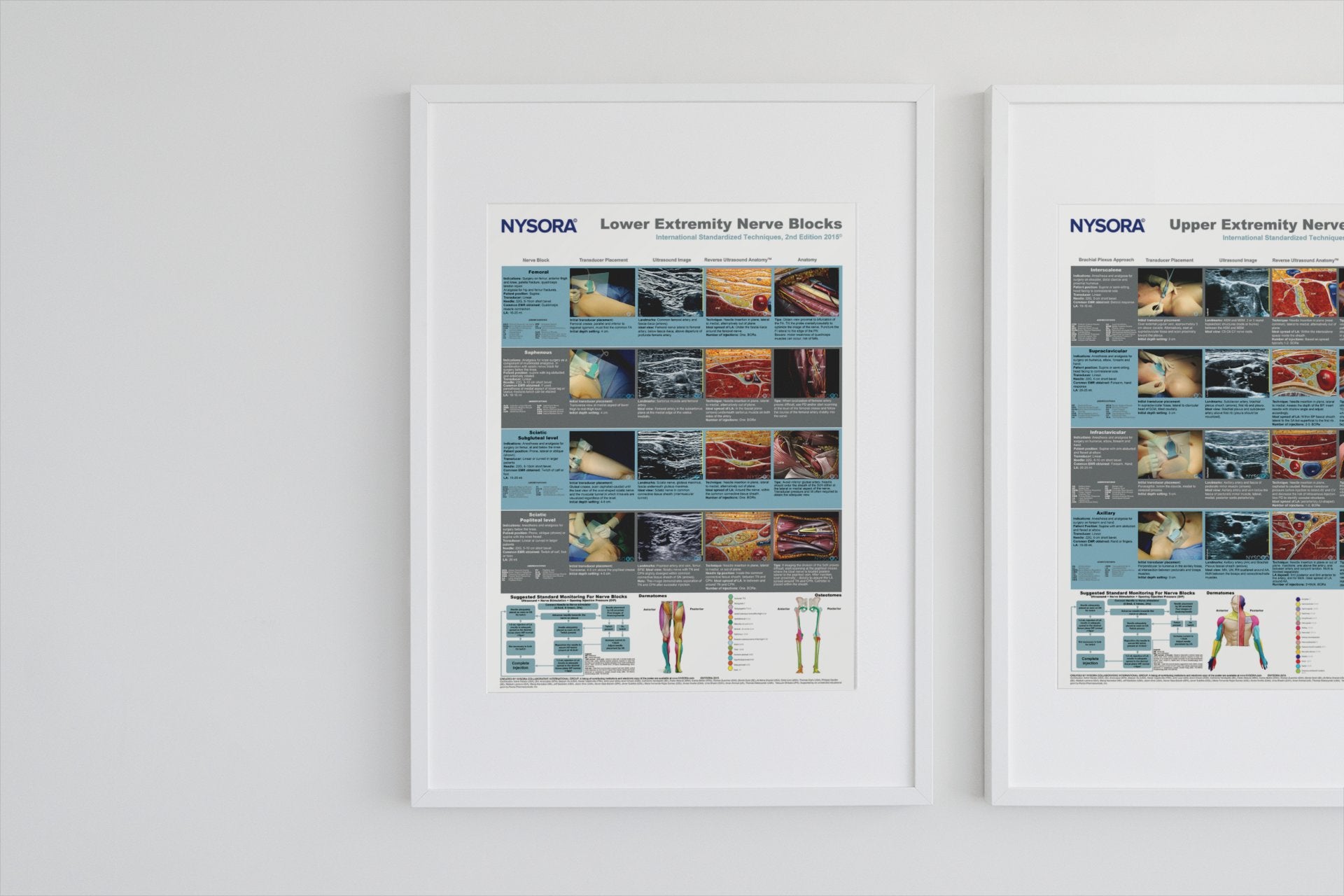 Lower Extremity Nerve Blocks Poster (in) – NYSORA