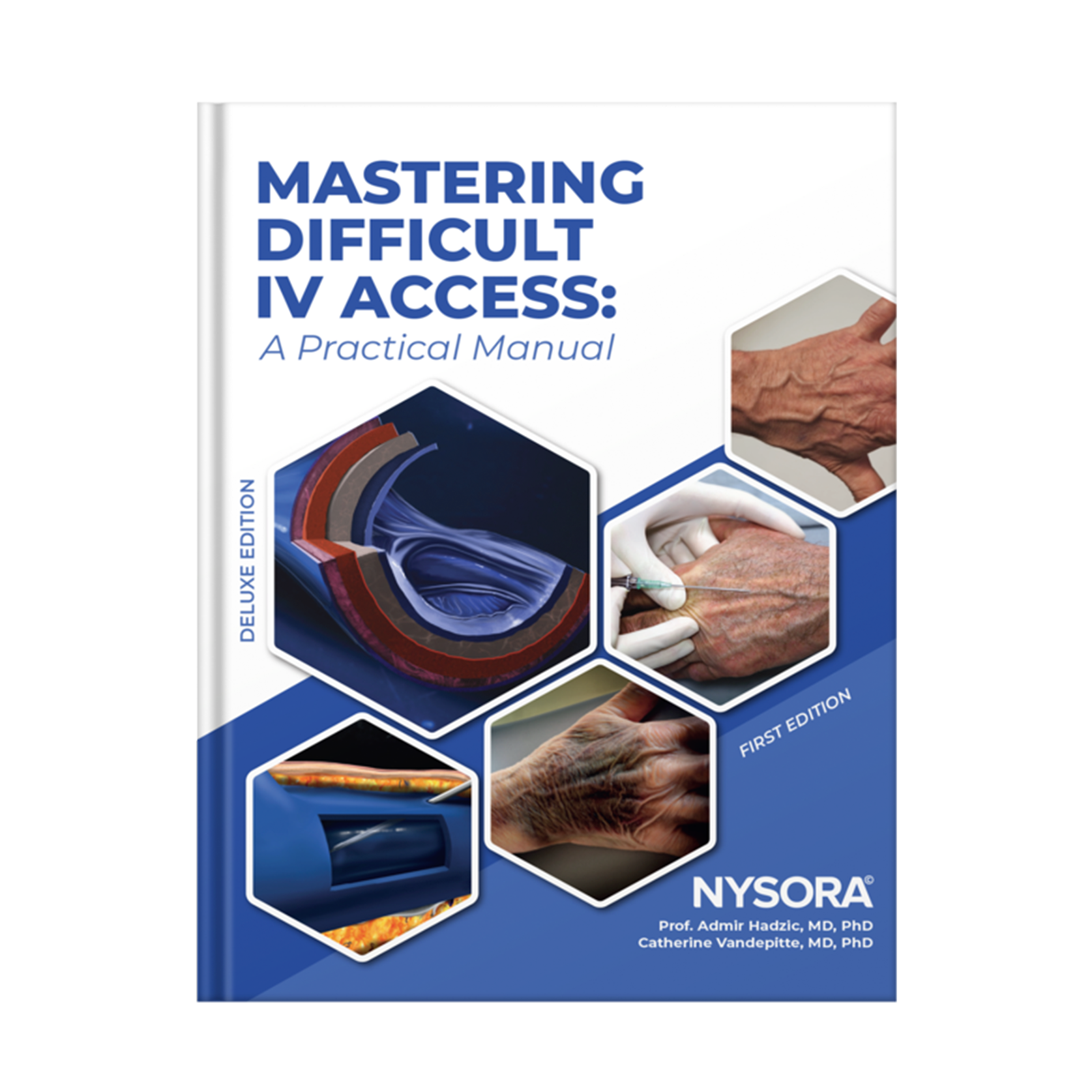 Mastering Difficult IV Access: A Practical Manual - Deluxe Edition Mastering Difficult IV Access: A Practical Manual - Deluxe Edition