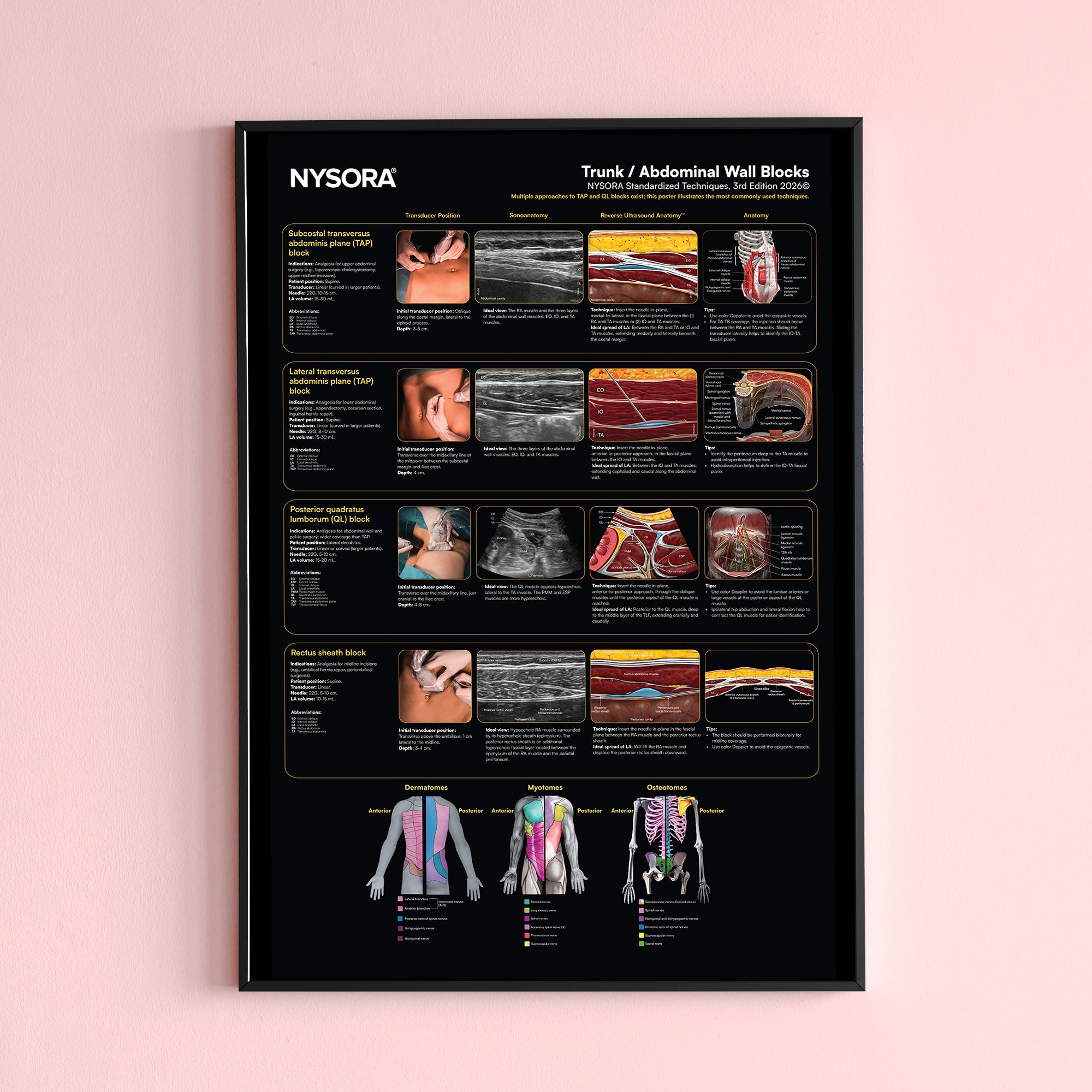Trunk/Abdominal Wall Blocks Poster – NYSORA