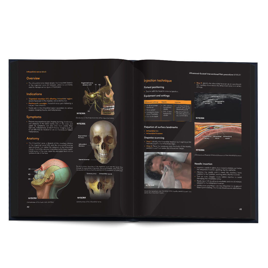 Ultrasound-Guided Interventional Pain Procedures Manual Deluxe Edition