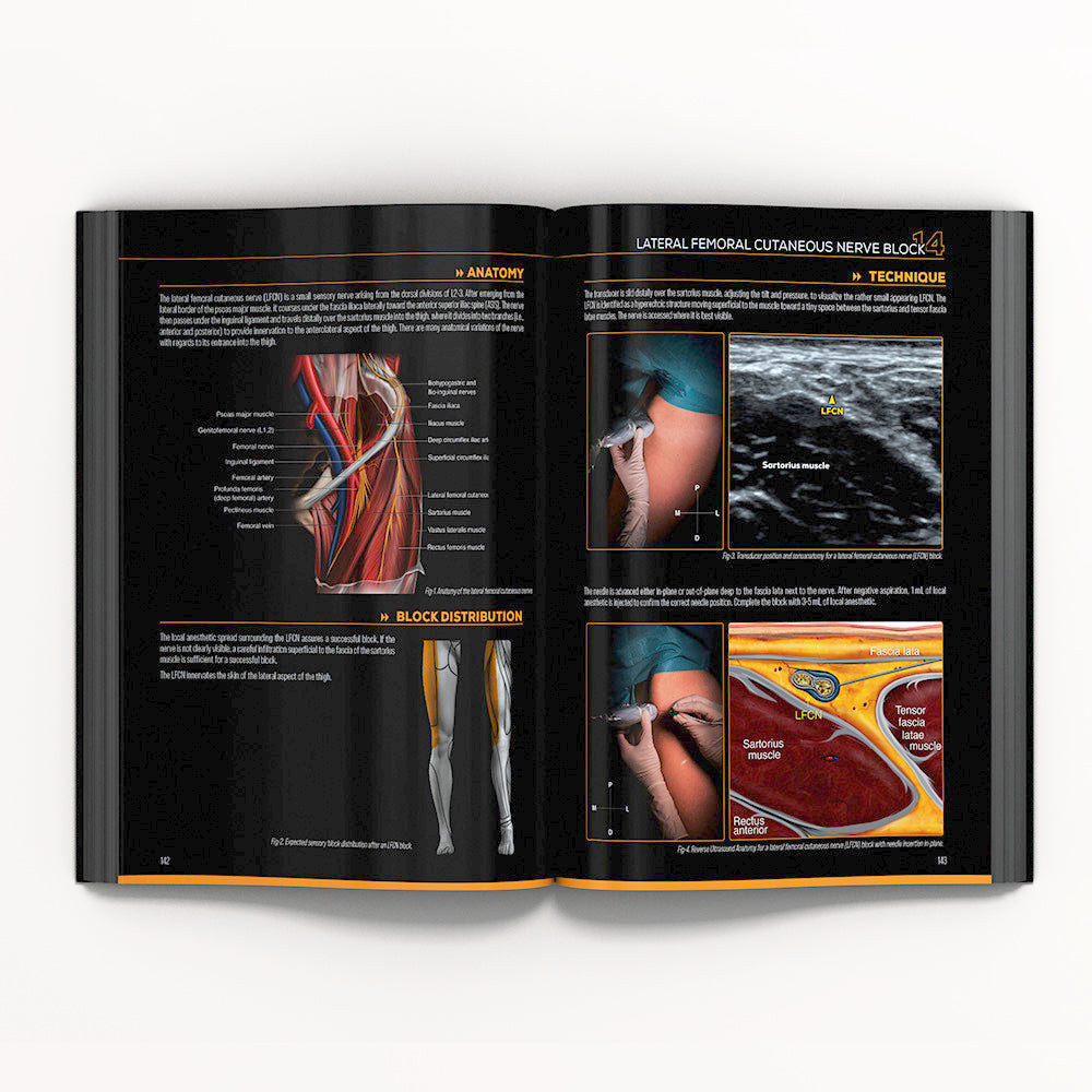 Lower Extremity Nerve Blocks Poster (in) – NYSORA