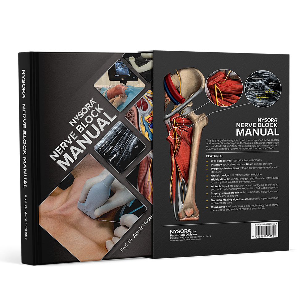 NYSORA Nerve Block Manual Deluxe Edition