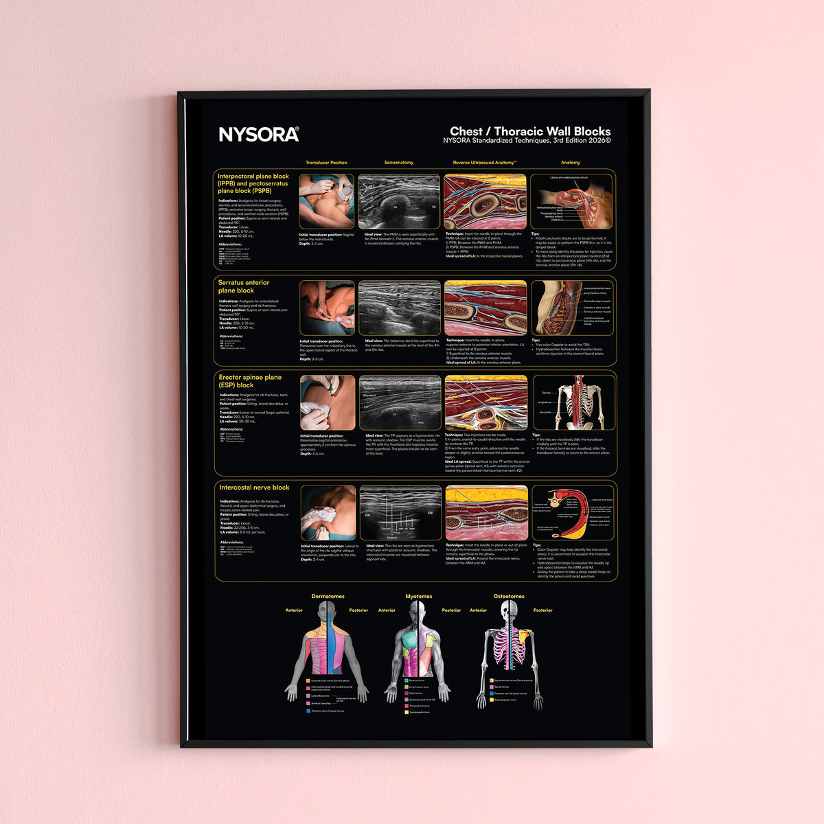 Chest/Thoracic Wall Blocks Poster – NYSORA