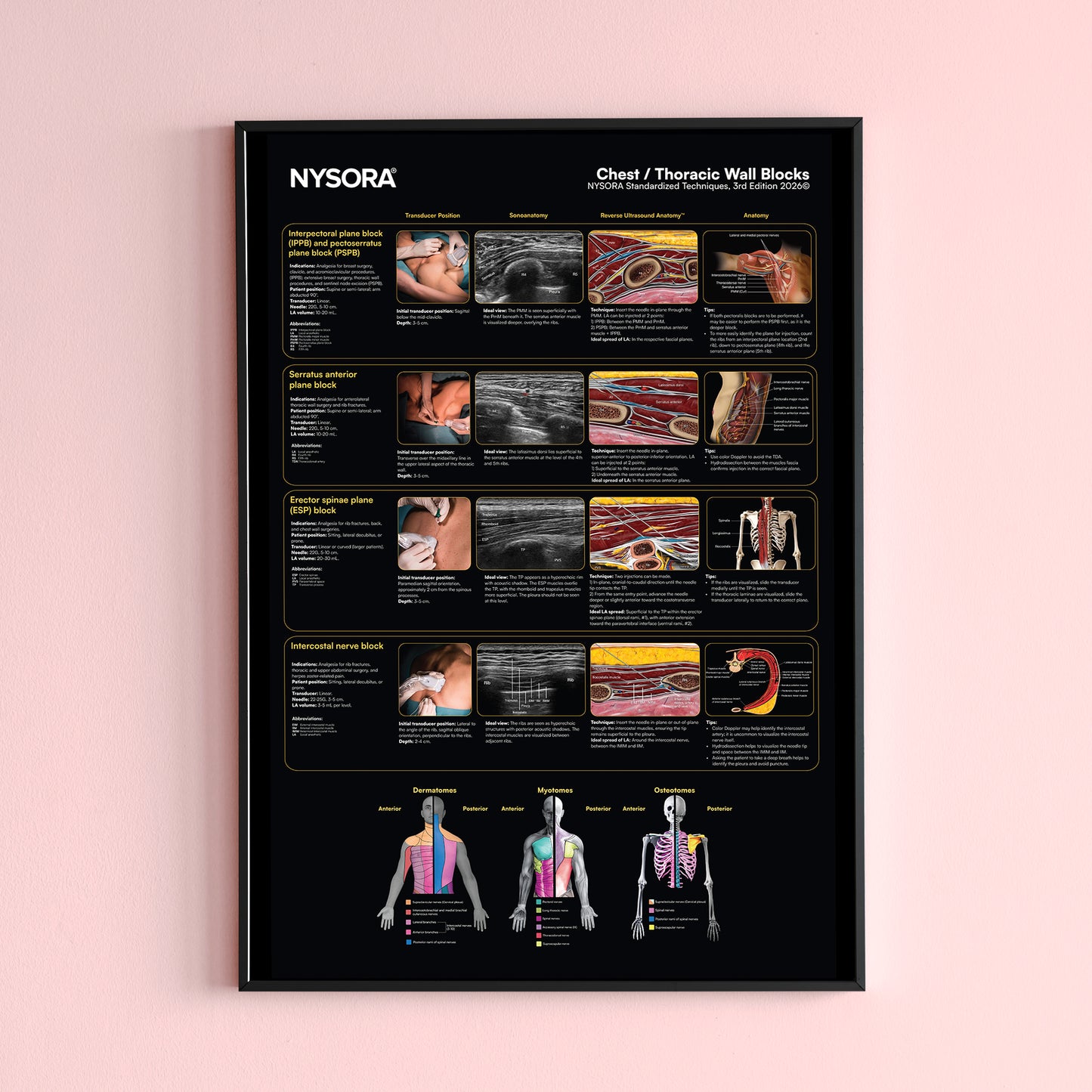Chest/Thoracic Wall Blocks Poster