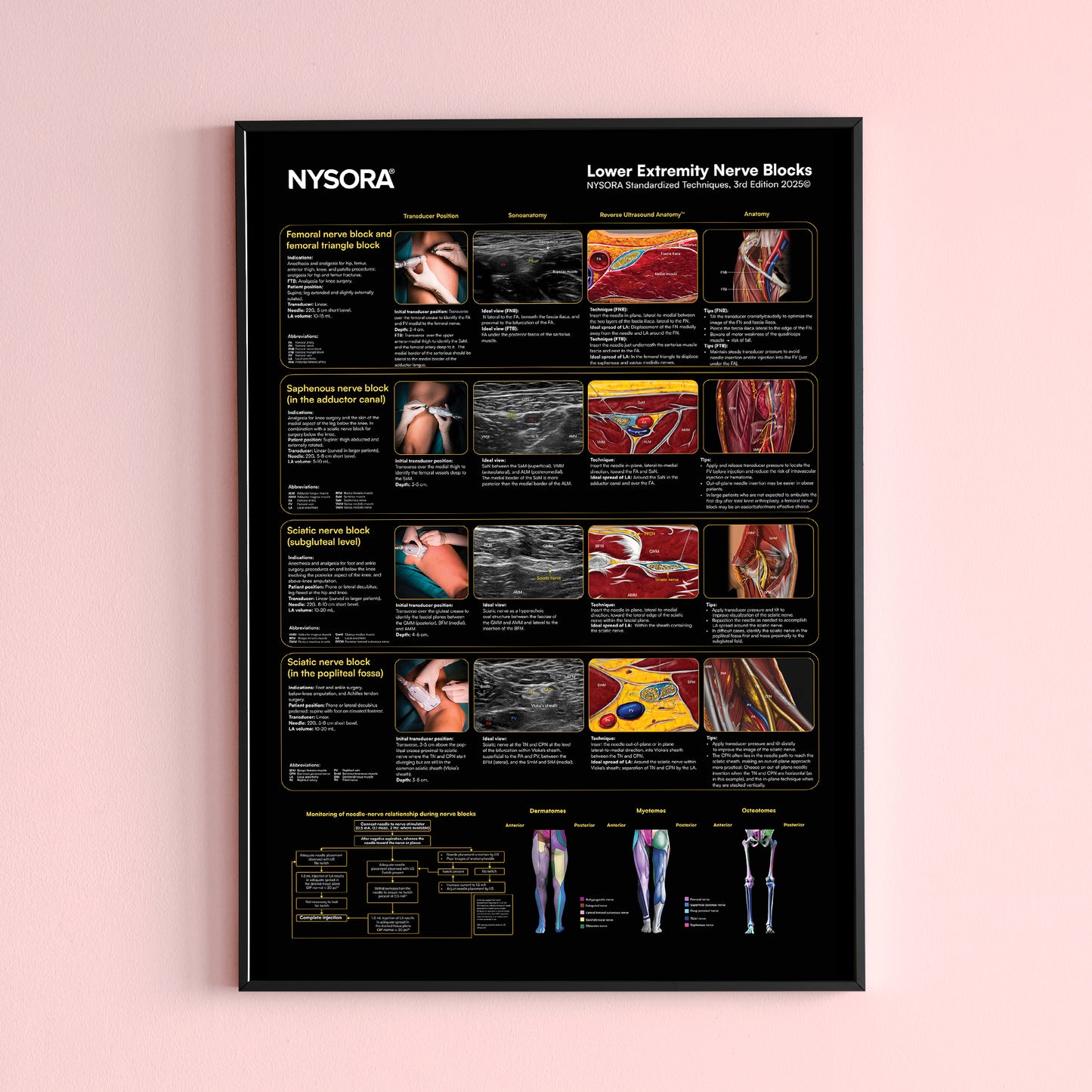 Lower Extremity Nerve Blocks Poster