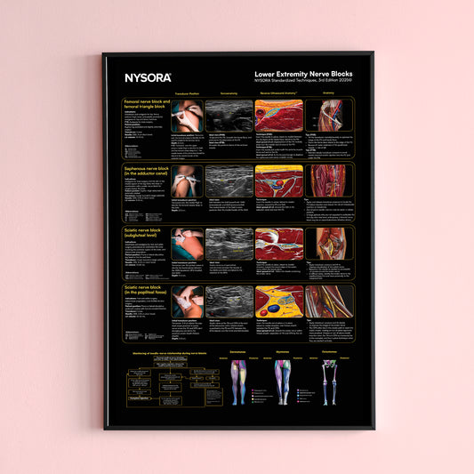 Lower Extremity Nerve Blocks Poster