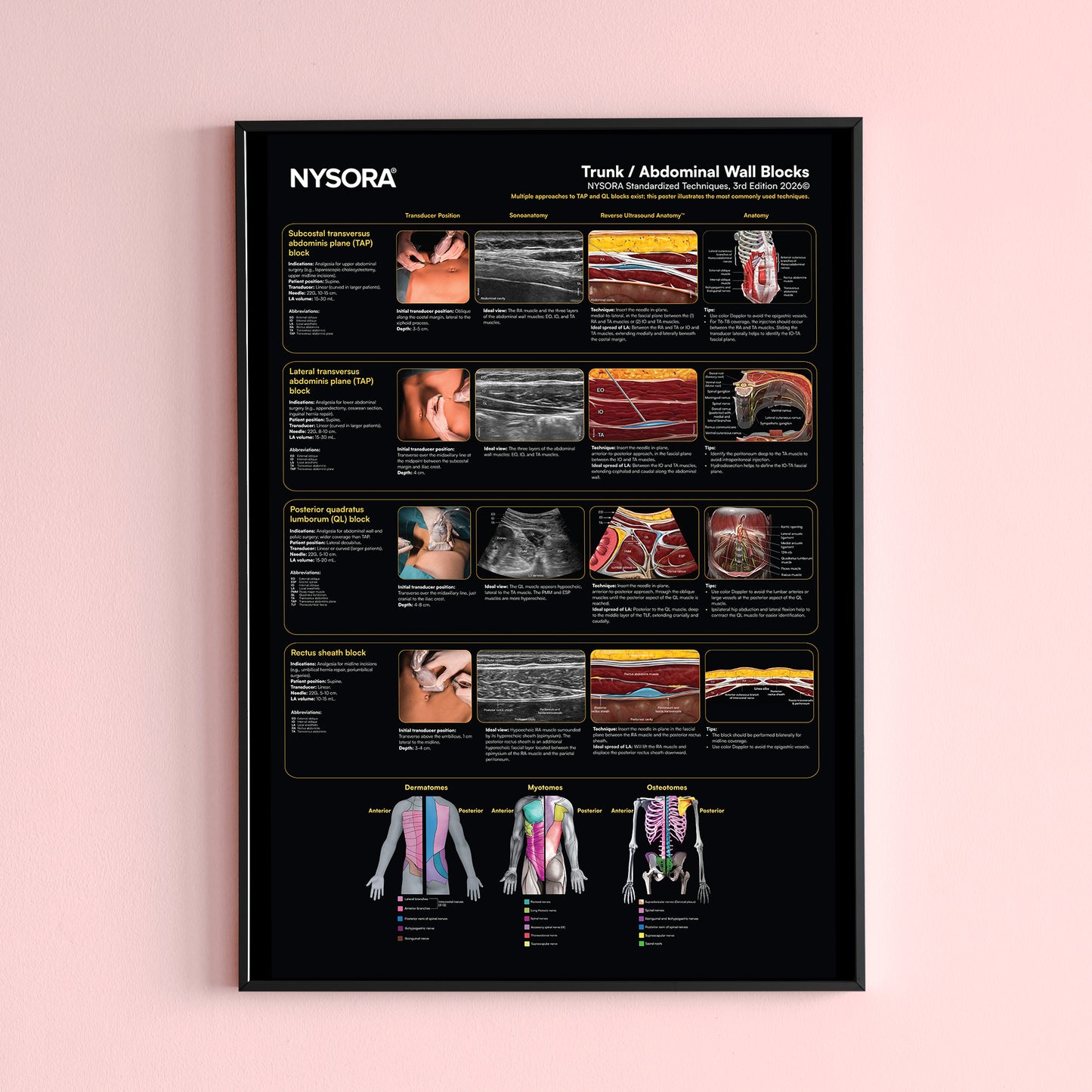 Trunk/Abdominal Wall Blocks Poster