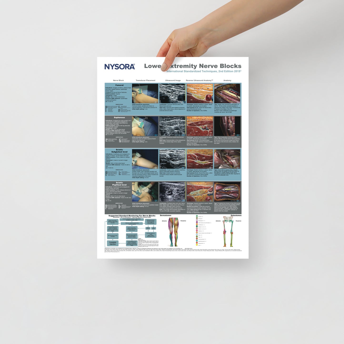 Lower Extremity Nerve Blocks Poster (cm)