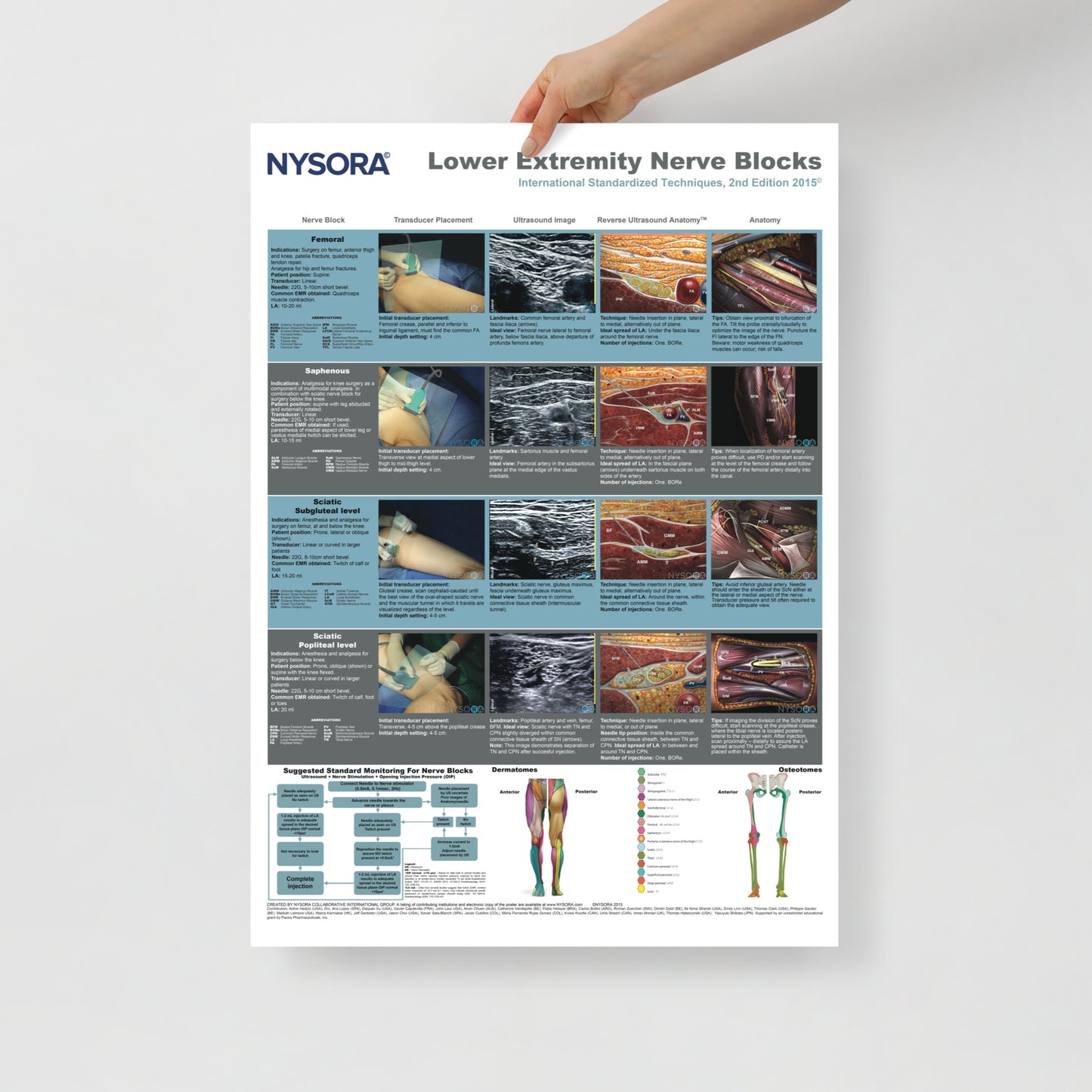 Lower Extremity Nerve Blocks Poster (cm)